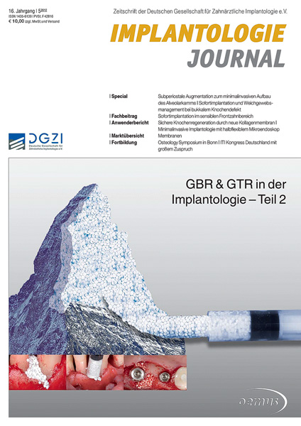 Anwenderbericht Zimny/Küffner zur Wiederherstellung der Ästhetik - Implantologie Journal 05/2012