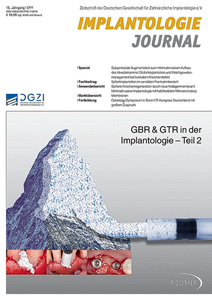 Anwenderbericht Zimny/Küffner zur Wiederherstellung der Ästhetik - Implantologie Journal 05/2012