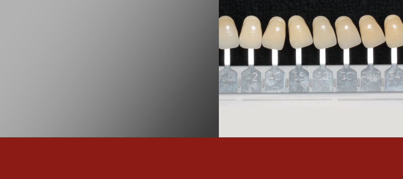 Die Farbe Bewertung der Zahnfarbe und möglicher Zahnverfärbungen anhand von Farbtabellen. 
